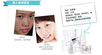 瓷肌痘印套装 专业修复，重现无瑕美肌——探索高效祛痘印护肤方案